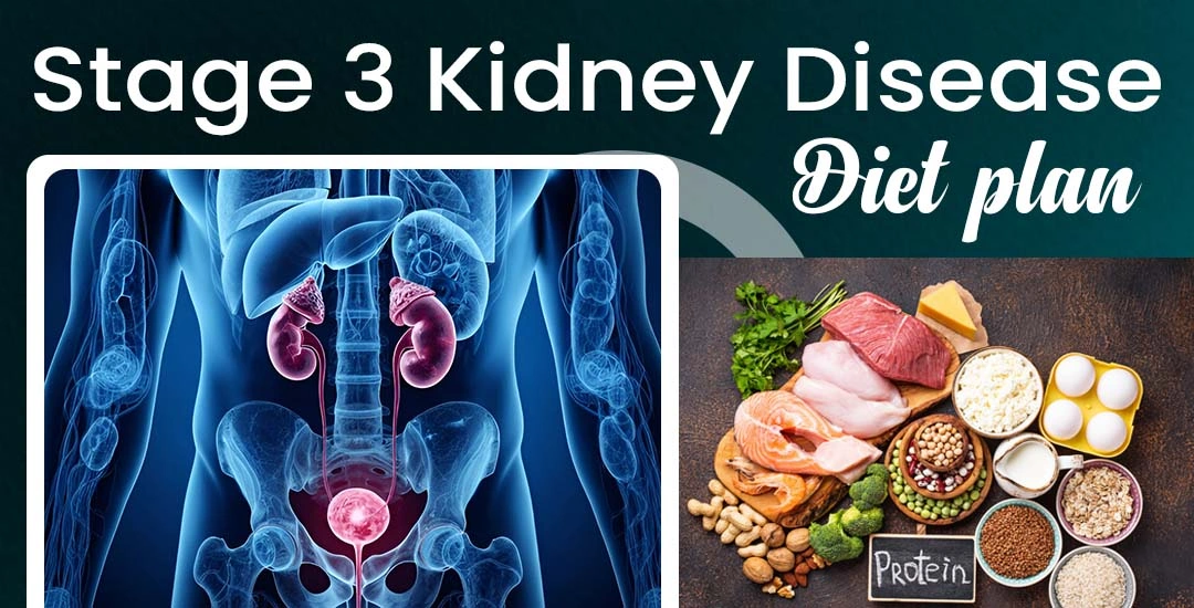 Stage 3 Kidney Disease Diet Plan (USA Guide): What to Eat & Avoid